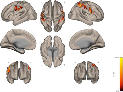 Thalamic functional connectivity and sensorimotor processing in neurodevelopmental disorders